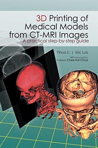 Read Online 3D Printing of Medical Models from Ct-Mri Images: A Practical Step-By-Step Guide - Eric Luis | ePub